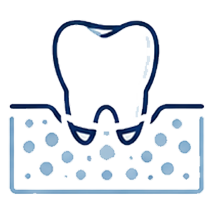 Dental bone grafting