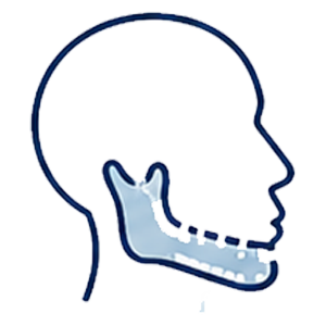 Jaw and facial surgery